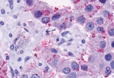 Immunohistochemistry: NK2R Antibody [NBP3-14421]